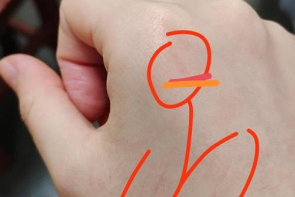 梦见猫抓我是什么预兆