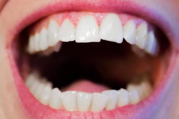 梦见剃头是什么预兆 男人