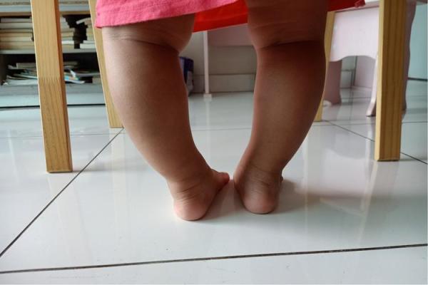 小孩外八字 小孩外八字