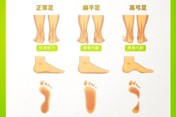 八字脚是什么 八字脚是什么