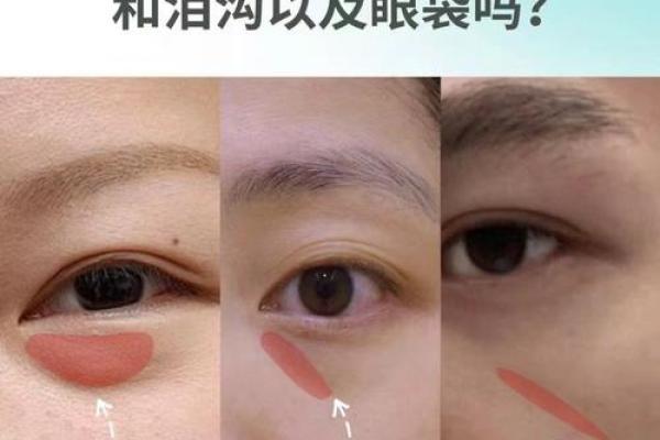 八字眼袋 八字眼袋