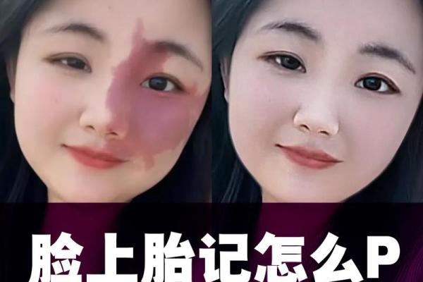 胎记算命图解：什么是红胎记？
