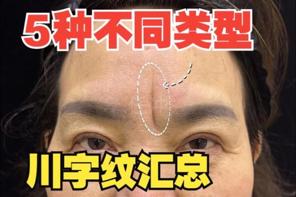 眉心凸起八字纹分析及治疗方法，了解眉心凸起八字纹原因