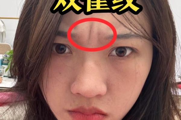 眉心凸起八字纹分析及治疗方法，了解眉心凸起八字纹原因