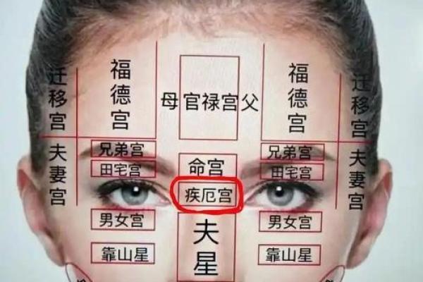 紫薇天相坐疾厄宫