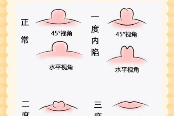 八字奶是什么意思