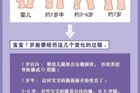 遇到宝宝罗圈腿、“八字脚”怎么办？宝妈莫着急，小编教给你
