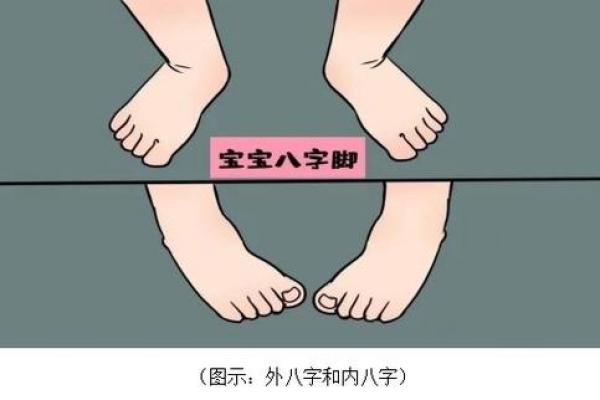 外八字危害