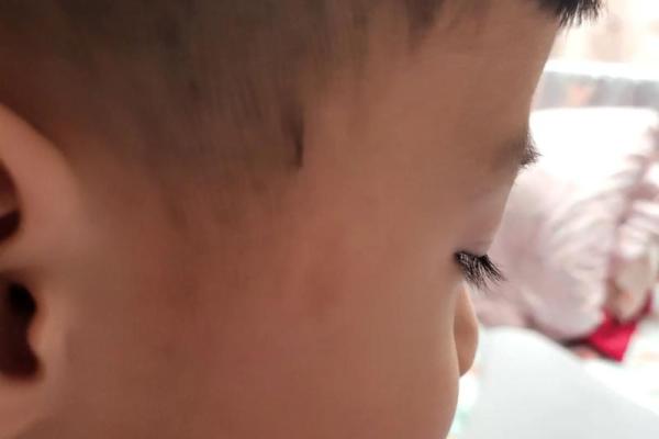 胎记算命胎记的位置与命运