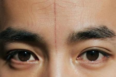 额头上的胎记算命