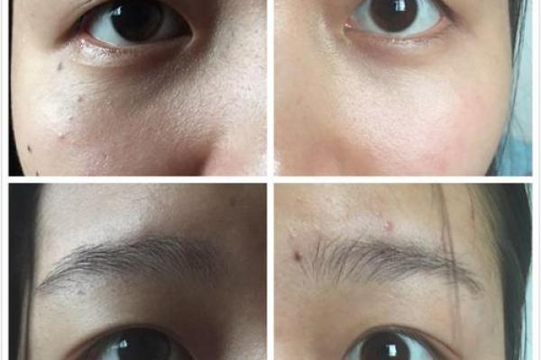 割双眼皮忌讳什么风水